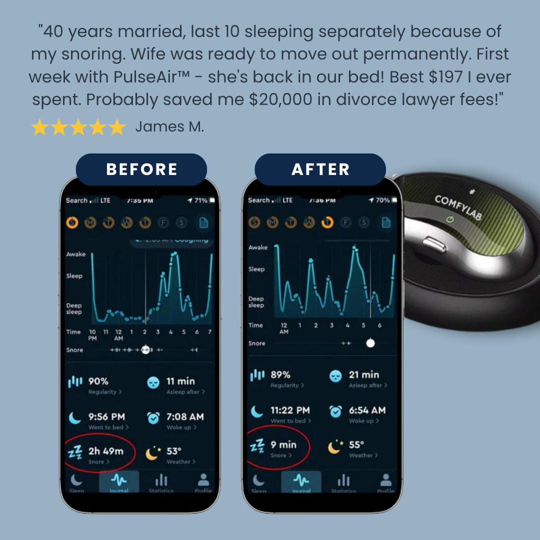 Comfylab PulseAir | Anti-Snoring Neurostimulation Device